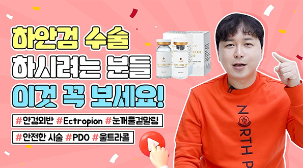 [바노바기 대전] 울트라콜