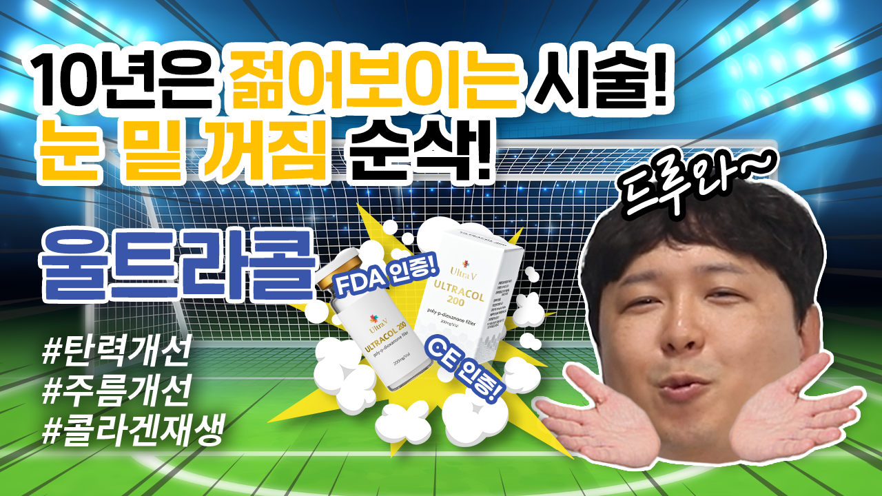[바노바기 대전] 울트라콜