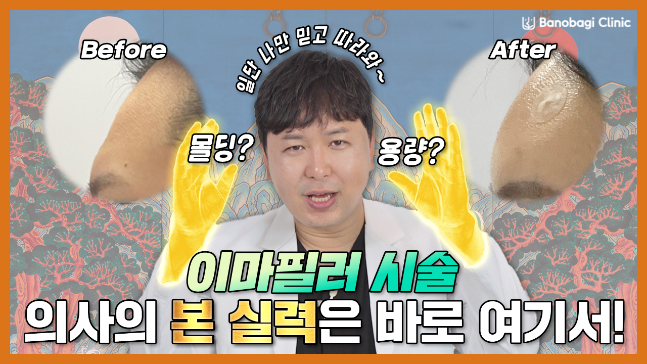 [바노바기 대전] 이마필러