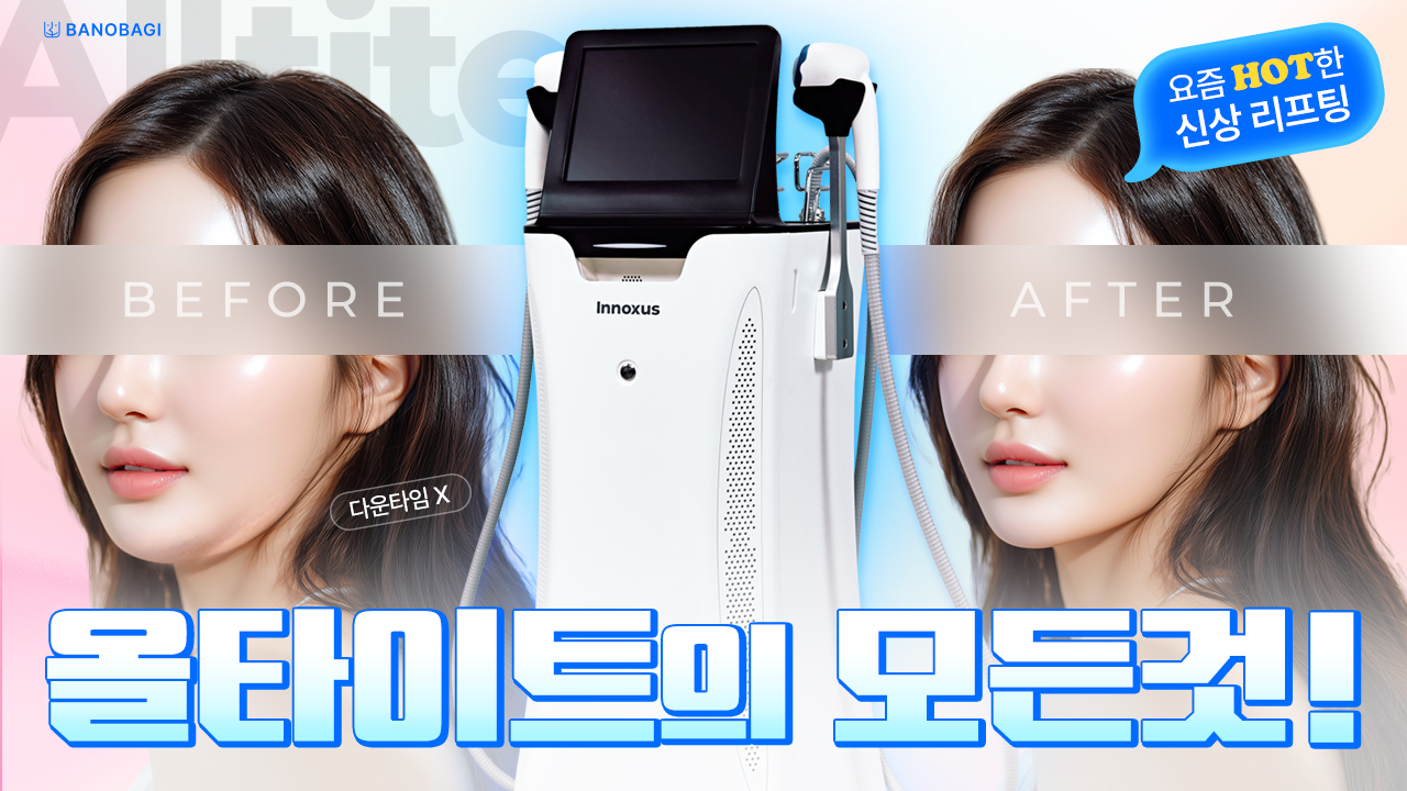 [바노바기 대전] 올타이트