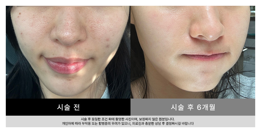 전후사진