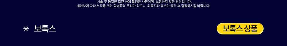 보톡스 상품