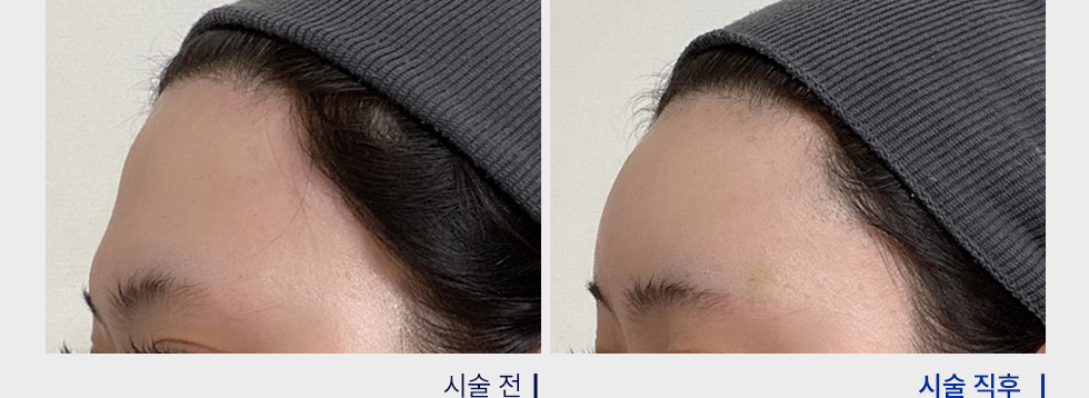 전후사진