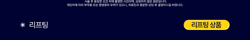 리프팅 상품